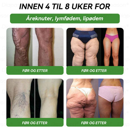 Offisiell butikk | 𝖣𝑖𝑎𝑝𝑎𝑠𝑜𝑛®🍒 𝐺𝐿𝑃-1 Sju-i-én kosttilskudd (munnløsning) (Kun én gang i uken – synlige resultater på bare 7 dager) ✅ For overvekt, hjerte- og karhelse, diabetes, søvnapné, leddplager og mer